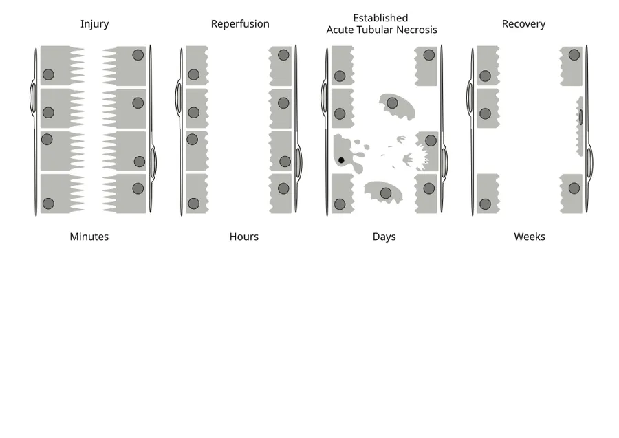 Cross sections of the proximal renal tubule at time intervals following ischaemic injury