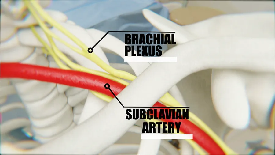 Brachial Plexus relation with the clavicle and subclavian artery