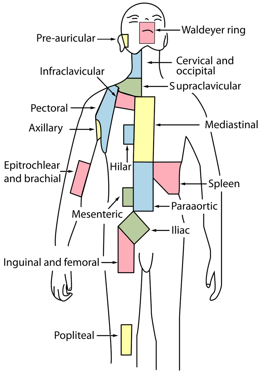Ann Arbor Hodgkin's Lymphoma; Lymph Node Regions
