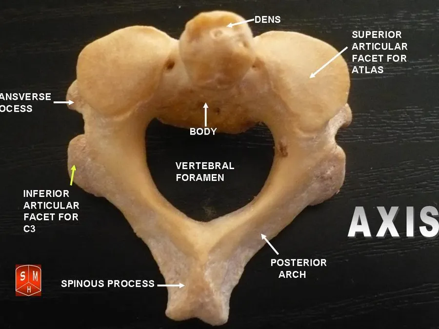 Axis vertebrae