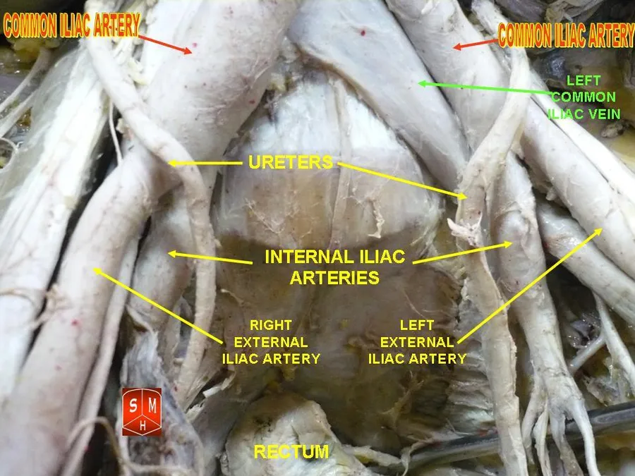Anatomical preparations