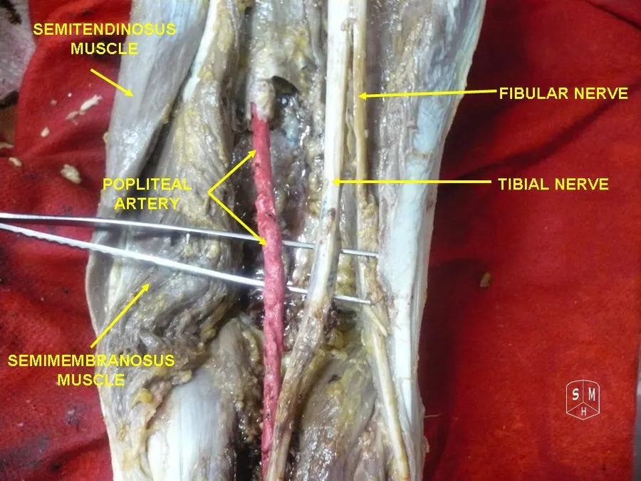 Tibial and fibular nerve