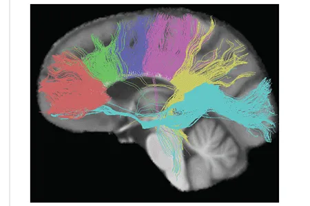 Fiber tracts from six segments of the corpus callosum providing interhemispheric linkage between specific cortical regions. The six segments and their fibers are identified as genu (coral), premotor (green), sensory-moto