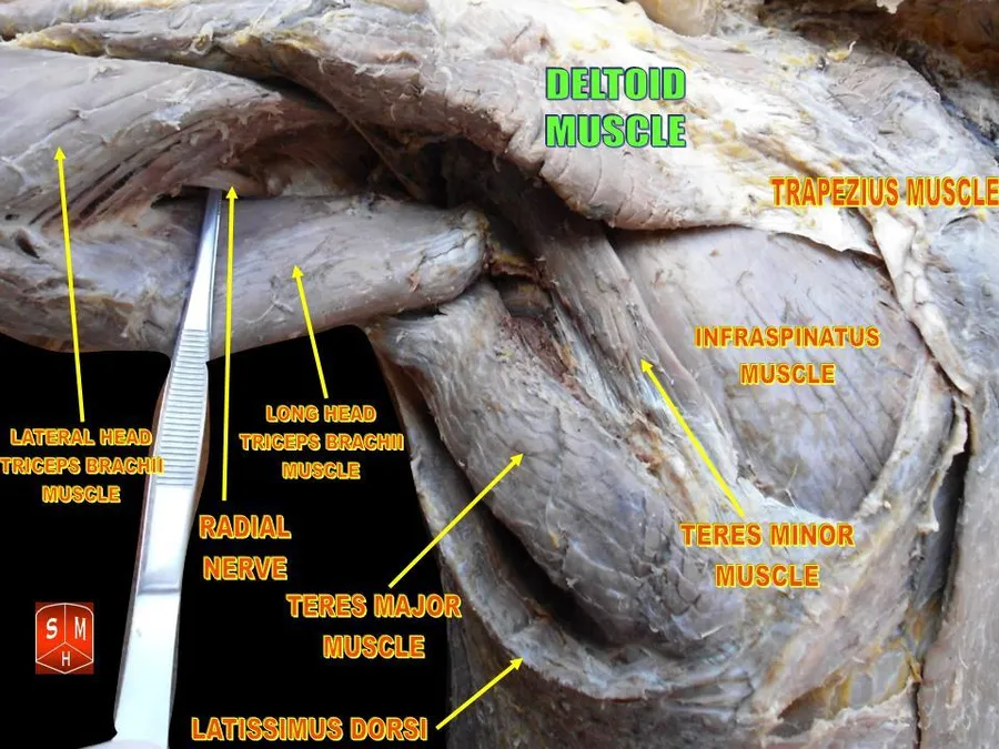 Anatomical dissections