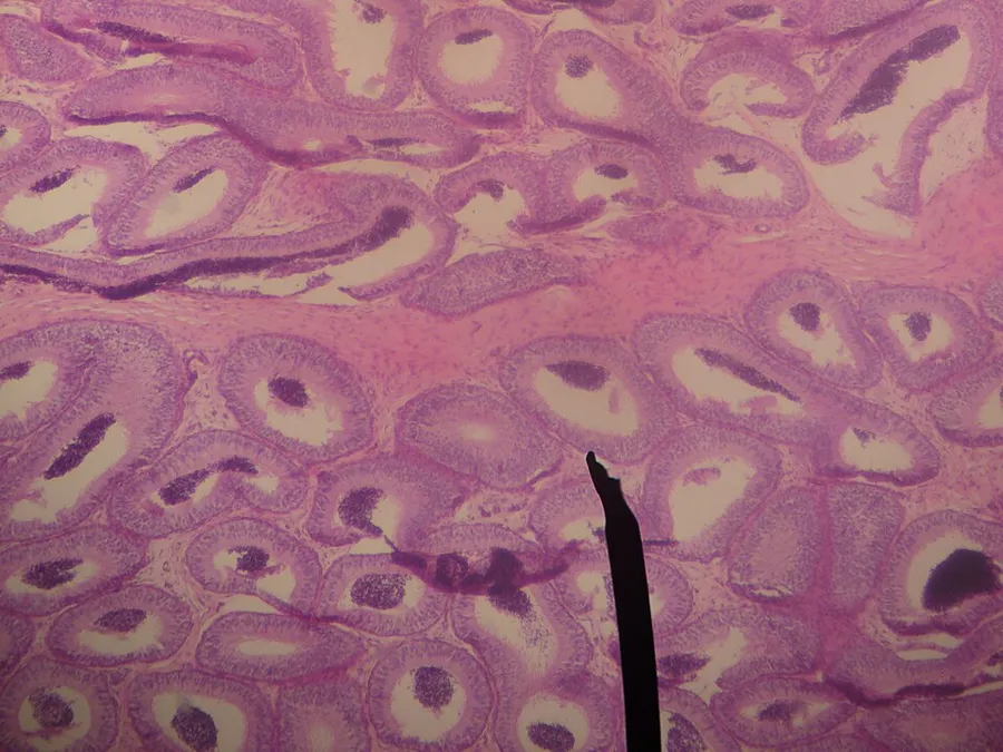 Author' own picture. Human epididymis. Digital camera shot through a microscope.