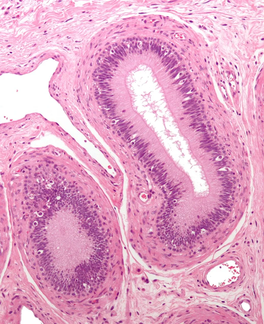 Micrograph of epididymis. H&E stain.