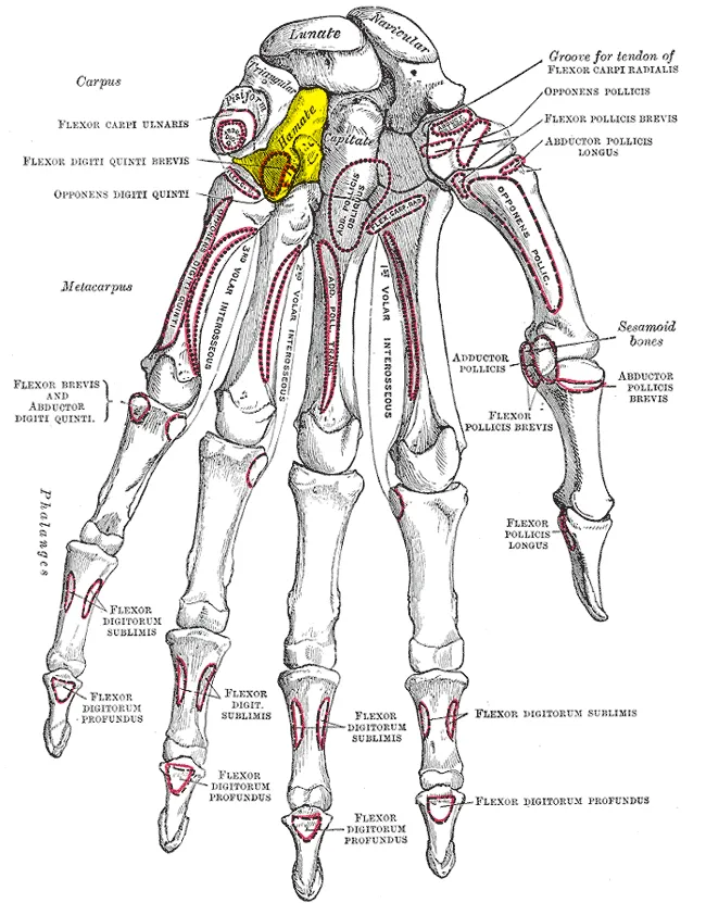 Hamate bone (shown in yellow).