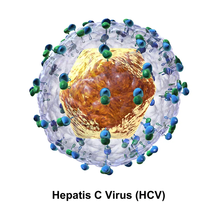 HCV.