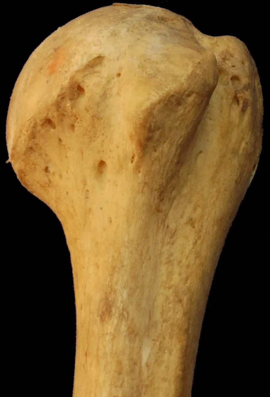 Photograph of anteromedial aspect (mostly anterior view) of left human humerus. Taken with Nikon D50 digital camera. Keywords: Human bones, bone, humerus.