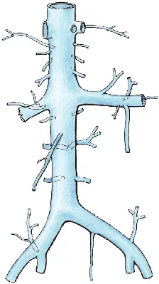 IVC, inferior vena cava