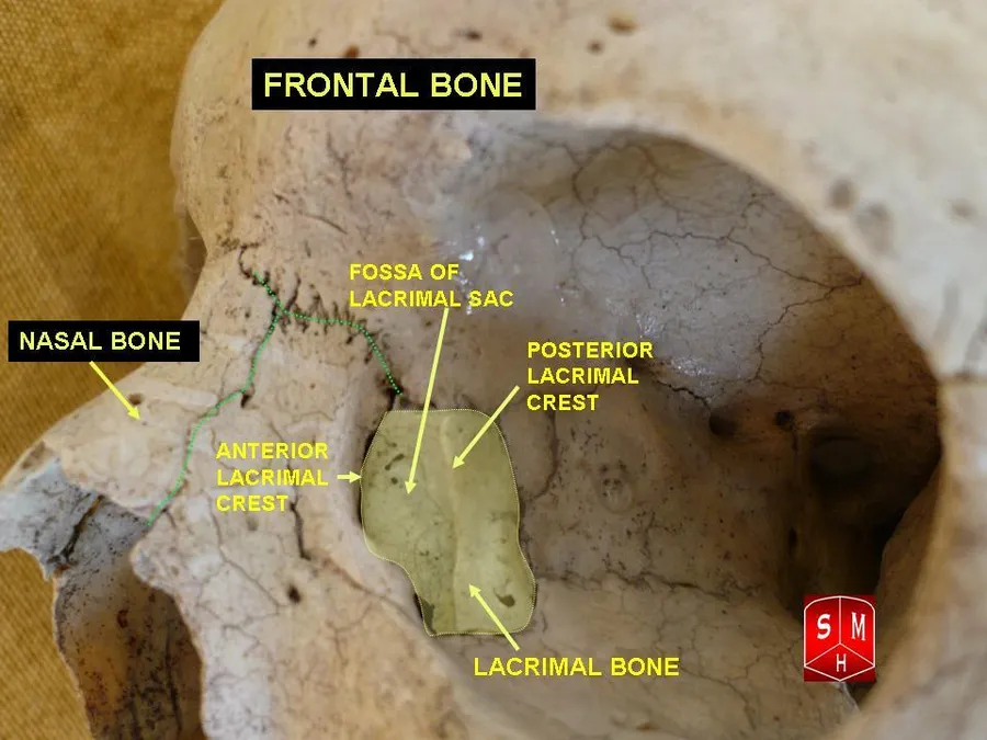 Lacrimal and nasal bones