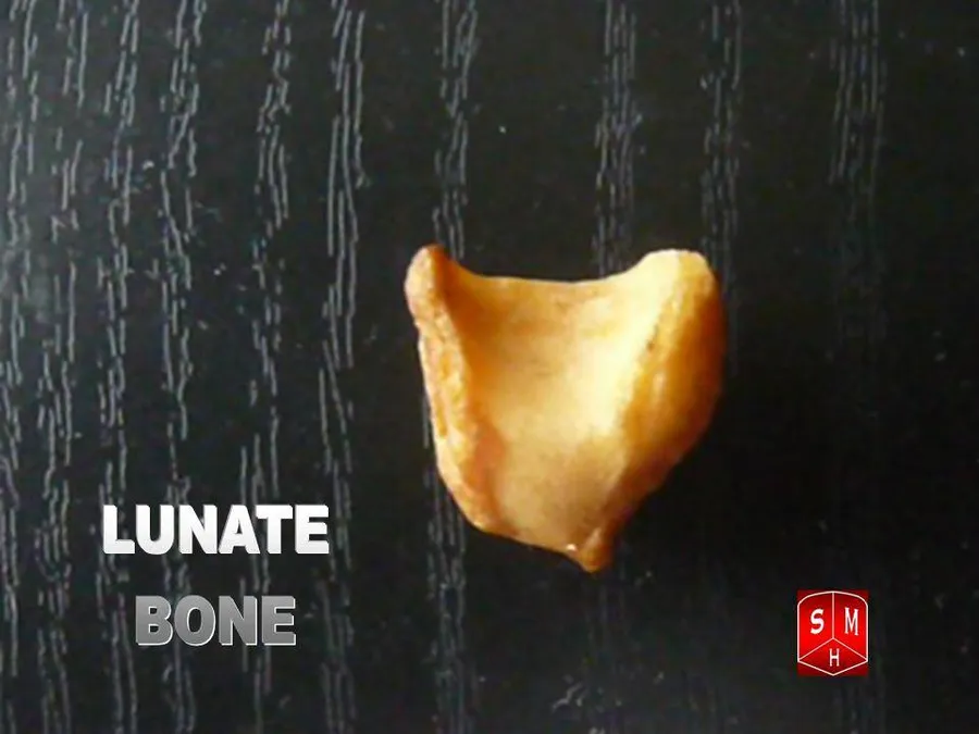 Lunate bone