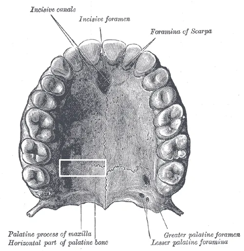 Palatomaxilláris varrat