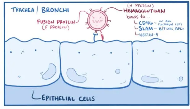 Image 5 of measles video, Understanding of measles spread in 2008.