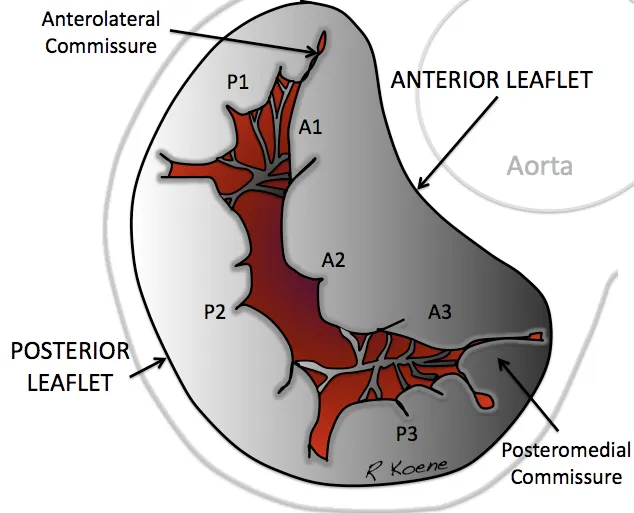 Mitral Valve.