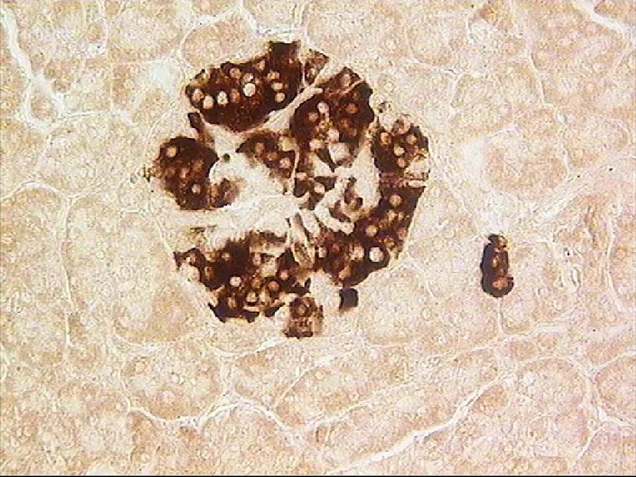 Streptavidin-biotin immunohistochemical technique, antibody to insulin Generated in Laboratory of nervous system development, FSBI Human Morphology SRI RAMS, Moscow