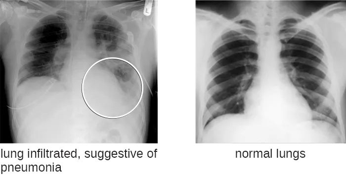 Name: Microbiology ID: e42bd376-624b-4c0f-972f-e0c57998e765@4.4 Language: English Summary: Subjects: Science and Technology Keywords: Print Style: License: Creative Commons Attribution License (by 4.0) Authors: OpenStax