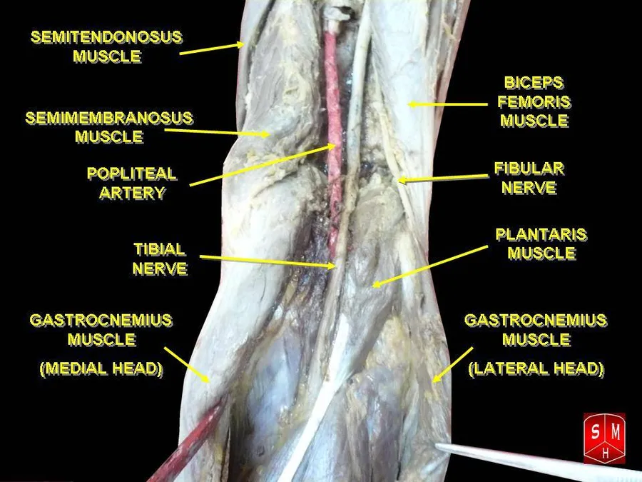 Lower limb anatomy