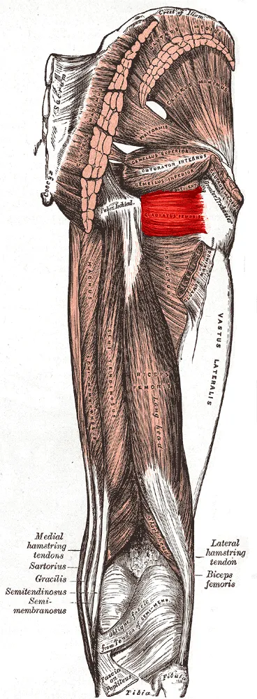 Muscles of the gluteal and posterior femoral regions with current muscle highlighted
