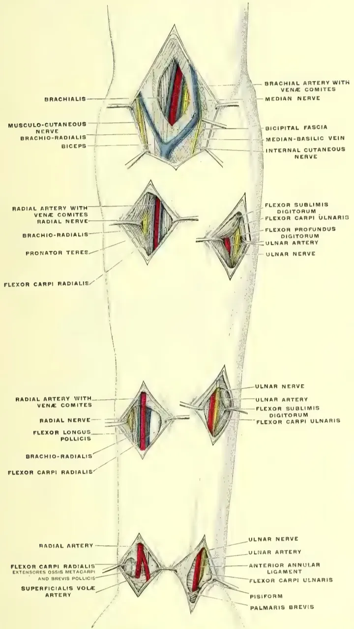 Anatomical drawing depicting the surgical relations of the radial and ulnar arteries of the forearm. to