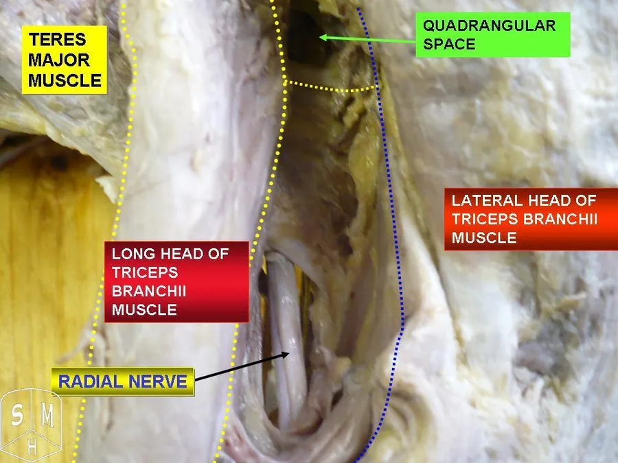 Radial nerve