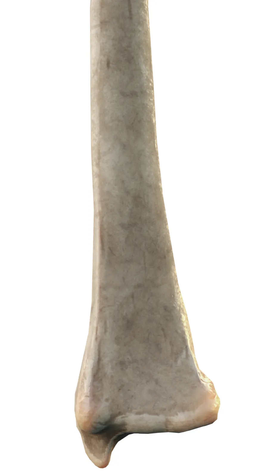Computer Generated 3d Model showing: Anterior View of Right Distal Radius. You can see the Radial Styloid Process, suprastyloid crest, Anterior border, anterior surface, lateral surface, and the interosseous border.