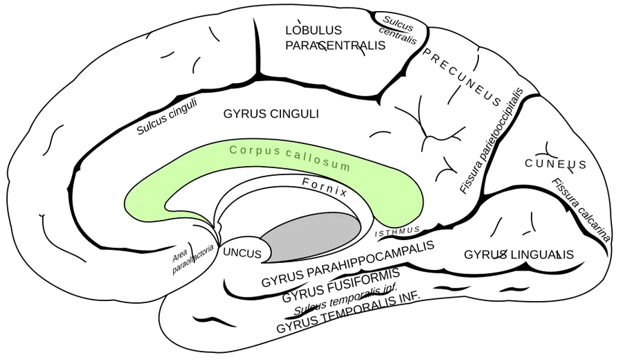 Corpus callosum on the medial surface of the right cerebral hemisphere.