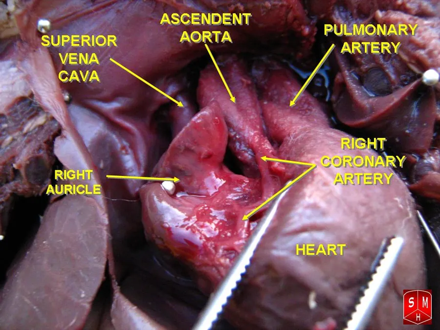 Dissection