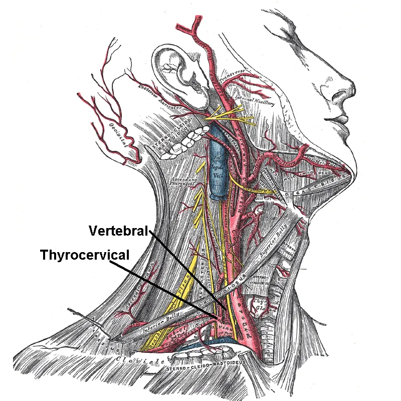Superficial dissection of the right side of the neck, showing the carotid and subclavian arteries. Branch of vertebral artery and thyrocervical trunk is labeled. Internal thoracic artery branches from same segment, but i