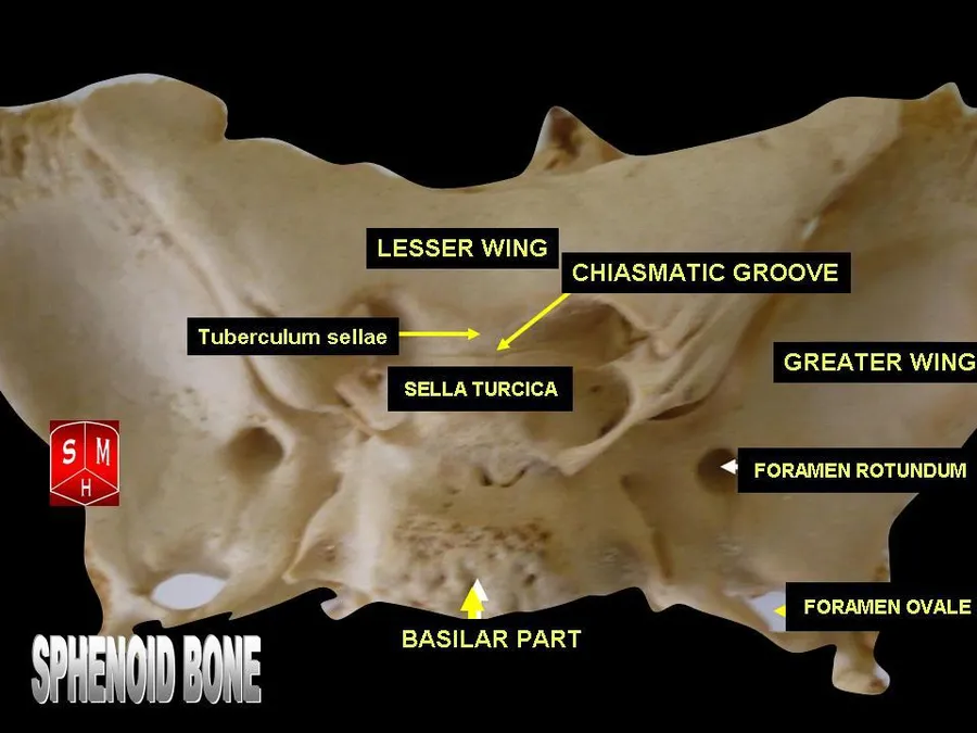 Sphenoid bone - superior view
