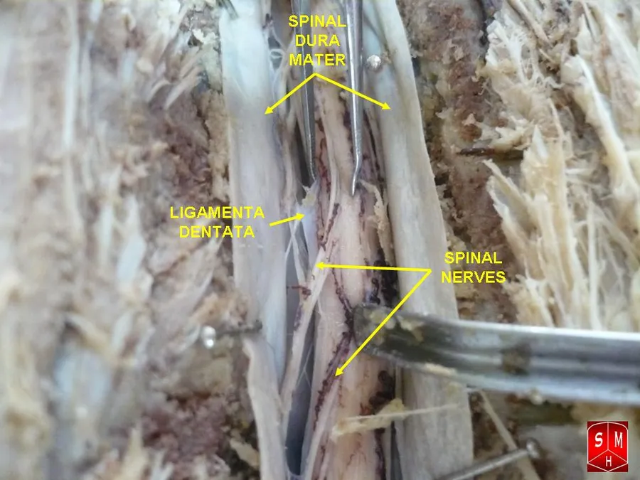Dissection of spinal cord