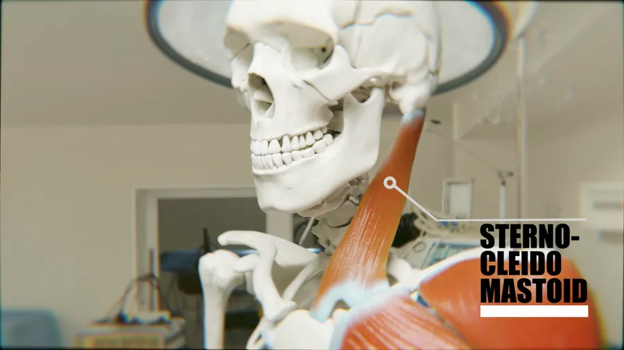 Sternocleidomastoid Muscle