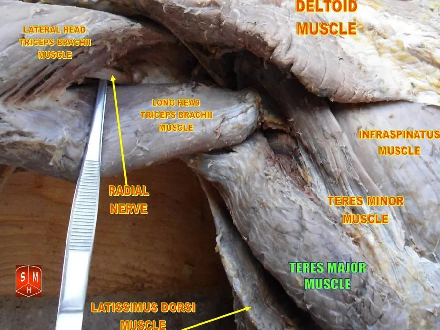 Anatomical dissections