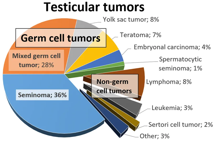 Relative incidences of testicular tumors. Reference: Gill MS, Shah SH, Soomro IN, Kayani N, Hasan SH (2000). "Morphological pattern of testicular tumors.". J Pak Med Assoc 50 (4): 110-3. PMID 10851829.