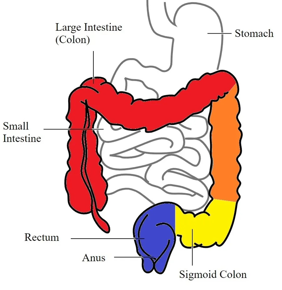 Representation of staging system for colitis, based on the Montreal classification, which is used to define the extent of involvement of ulcerative colitis. Proctitis (blue), proctosigmoiditis (yellow), left sided coliti