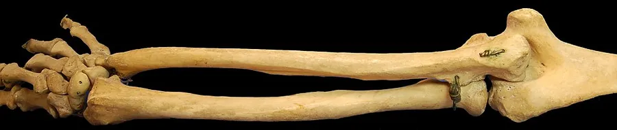 Photograph of right posterior human radius and ulna. Keywords: Human bones, bones, wrist, radius, ulna.