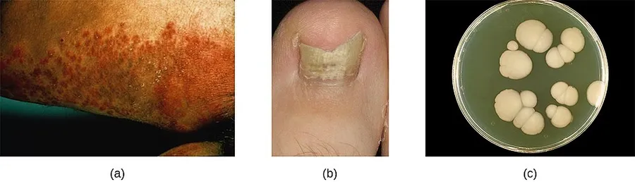 Name: Microbiology ID: e42bd376-624b-4c0f-972f-e0c57998e765@4.4 Language: English Summary: Subjects: Science and Technology Keywords: Print Style: License: Creative Commons Attribution License (by 4.0) Authors: OpenStax